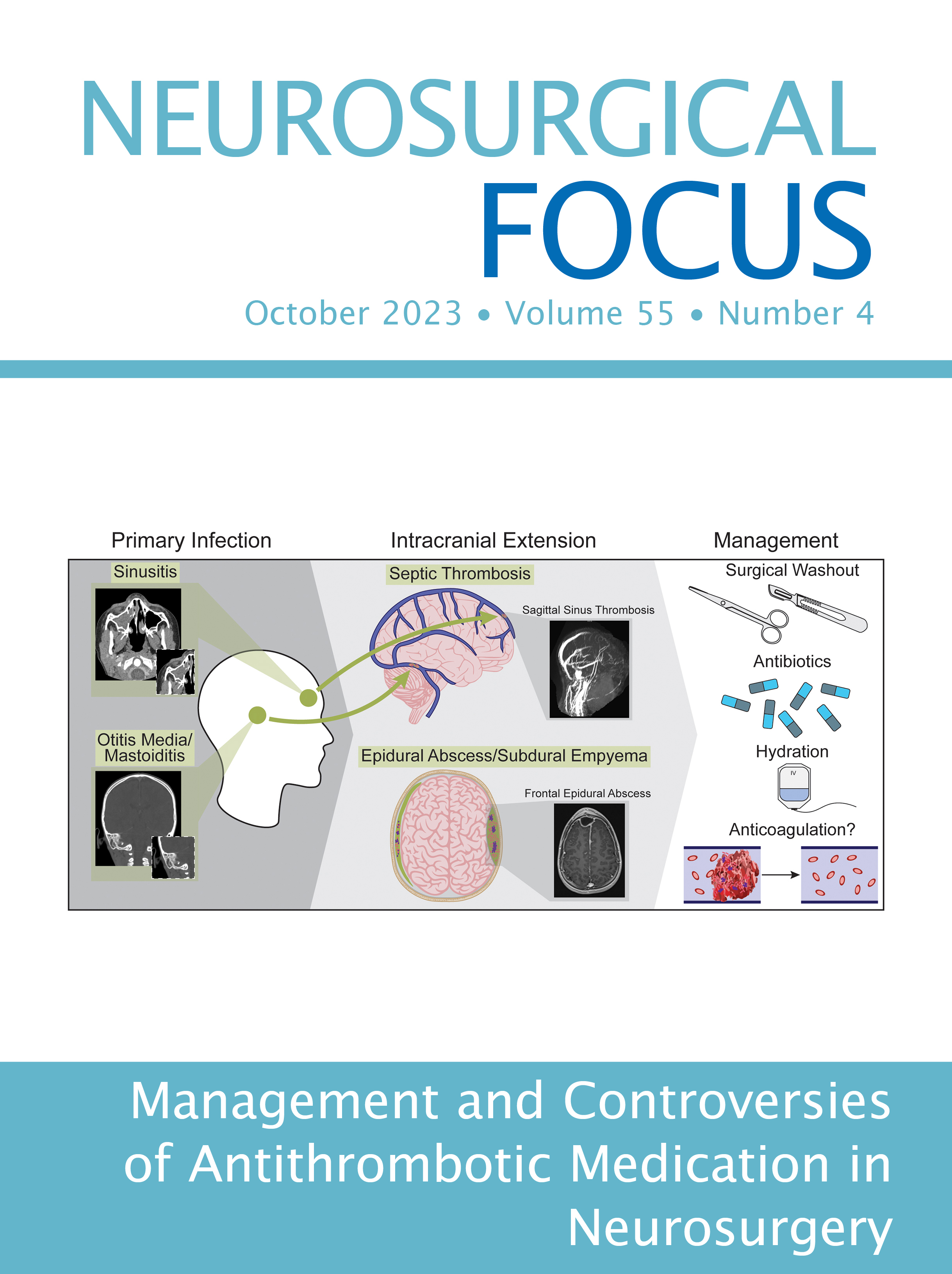 Volume 55: Issue 4 (October 2023): Management and Controversies of Antithrombotic Medication in Neurosurgery